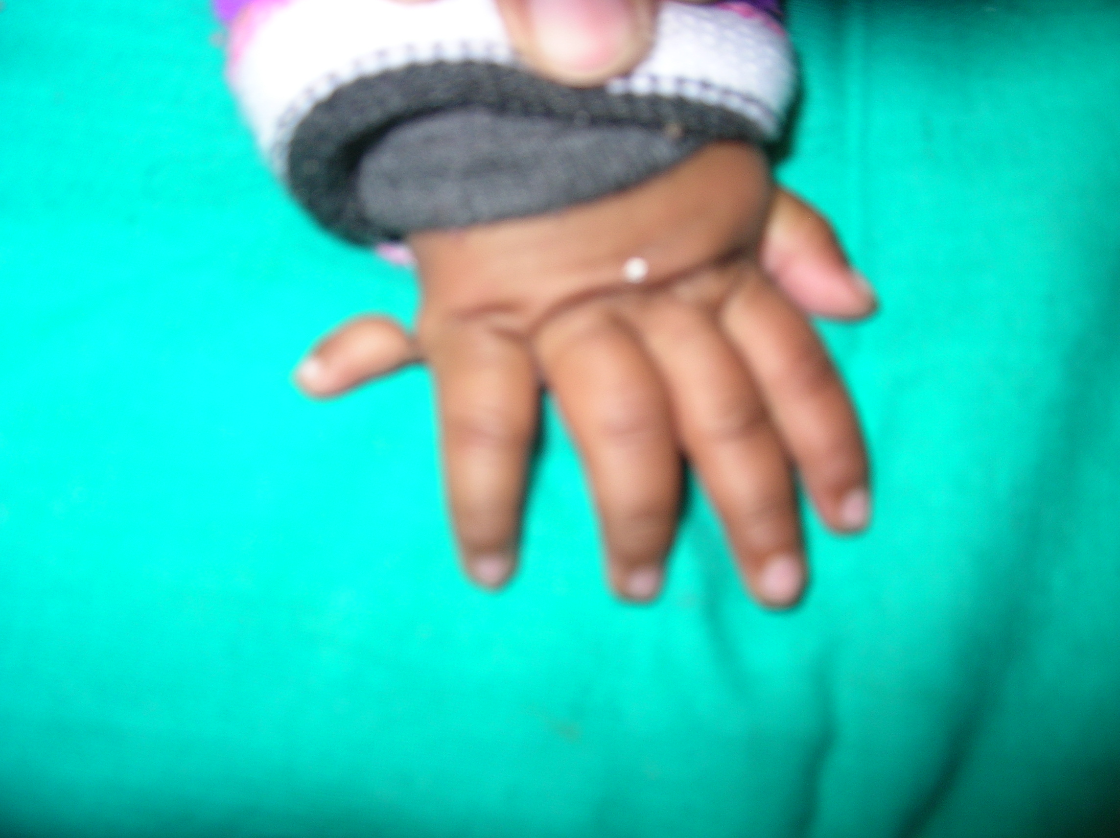 Pediatric Plastic Surgery Image 5